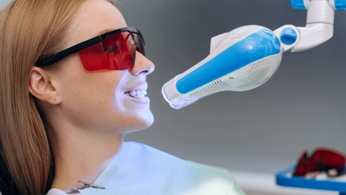 How Long Does Teeth Whitening Last? A Complete Bleaching Guide
