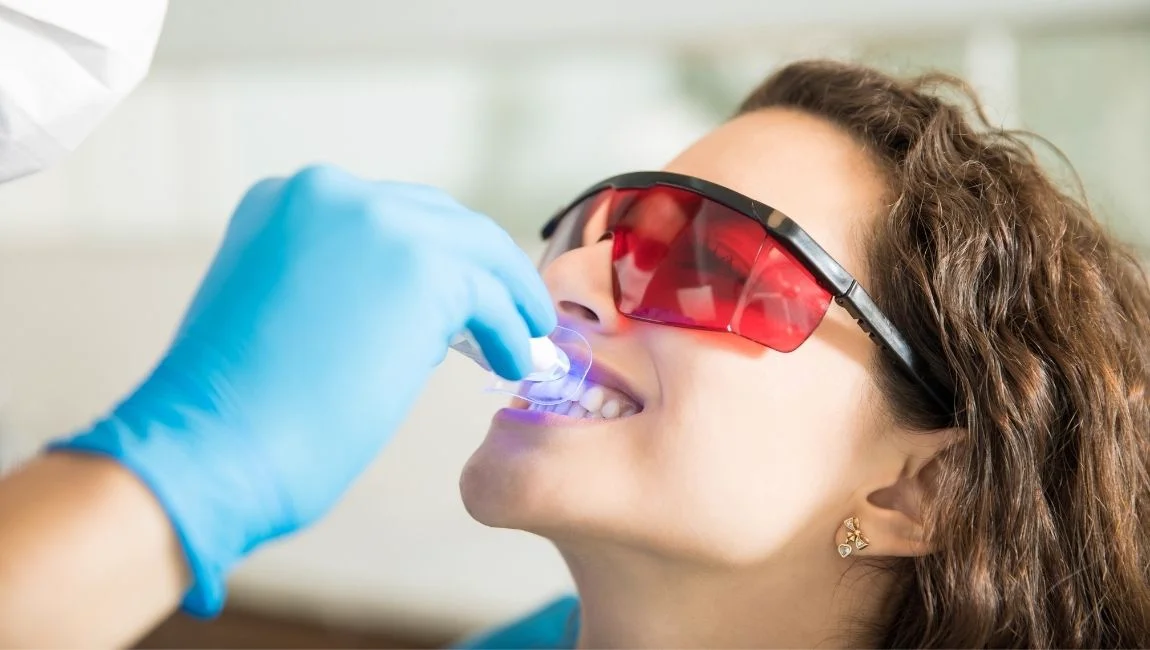 Why Do Teeth Turn Yellow? What Do We Need to Know About Teeth Whitening?