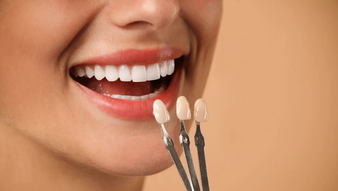 Does Dental Veneer Treatment Hurt? Are the Procedures Performed in Turkey Safe?