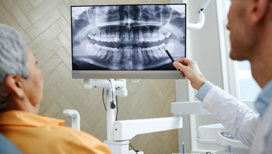 Zygomatic Solution for Bone Deficiency: How Is Zygomatic Implant Done and Who Is It Suitable For?